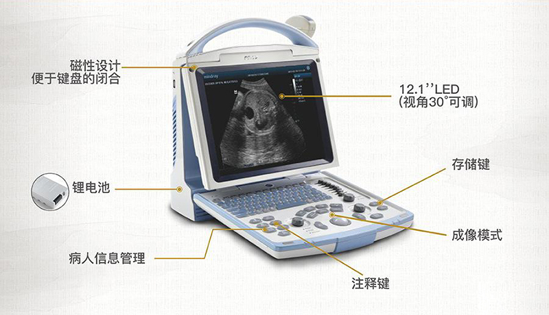 B超機(jī)的基本構(gòu)件包括發(fā)射、掃查、接收、信號處理和顯示等五個主要組成部分，分別分為兩大部件，即主機(jī)和探頭。